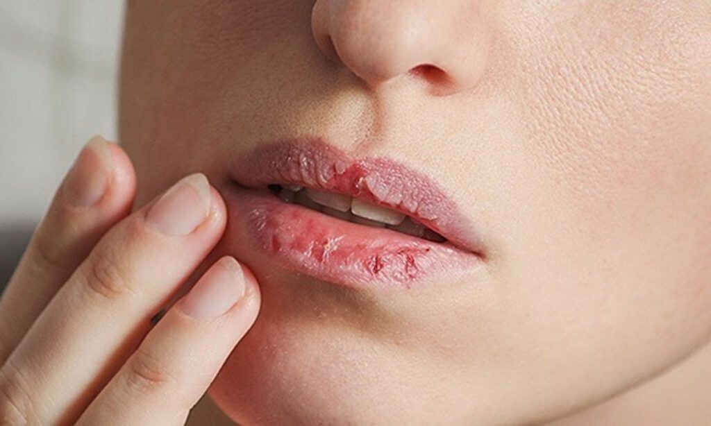 Hình minh họa dấu hiệu hạ thân nhiệt