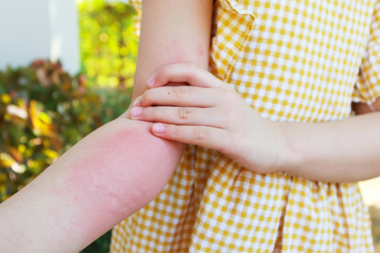 Hình minh họa phân chim và dơi là môi trường lý tưởng để nấm Histoplasma sinh trưởng