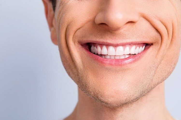 Râu rồng là gì? giải pháp hiệu quả để xóa mờ nếp nhăn rãnh cười