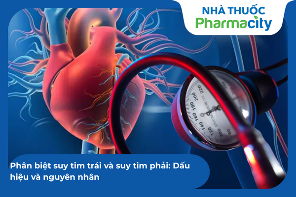 Phân biệt suy tim trái và suy tim phải: Dấu hiệu và nguyên nhân