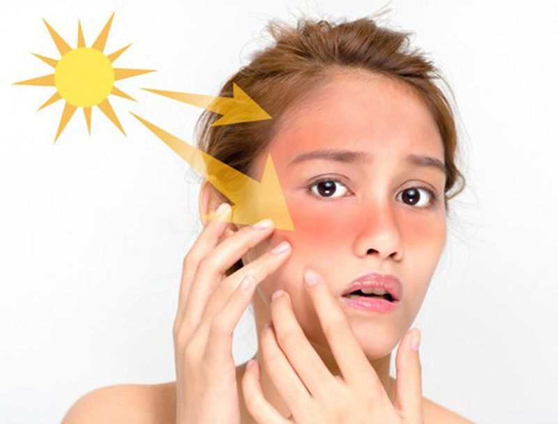 Cần điều trị sớm để tránh tổn thương da sâu và các biến chứng lâu dài do tia UV
