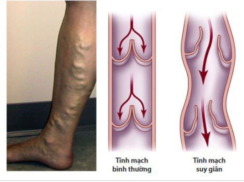 Thăm khám y khoa giúp xác định nguyên nhân gây tĩnh mạch cổ nổi