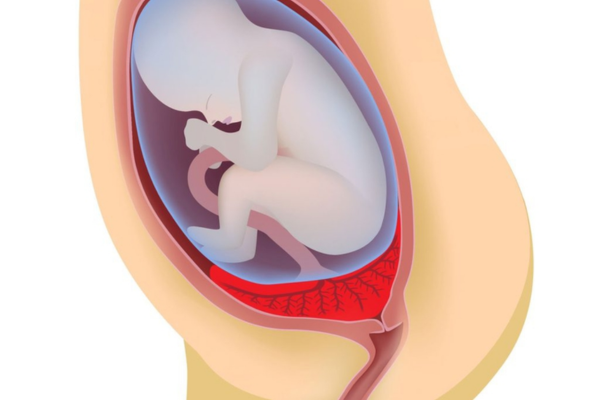 Việc quản lý thai kỳ nguy cơ cao tại các cơ sở y tế chuyên khoa giúp kiểm soát tốt các biến chứng cho cả mẹ và con 