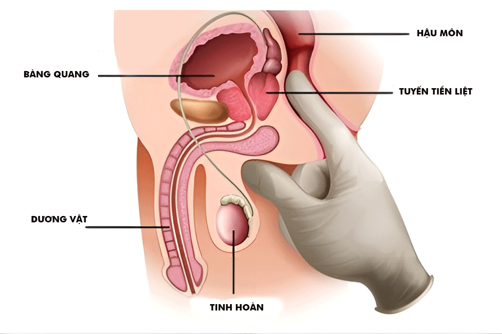 Hình minh họa các bệnh lý