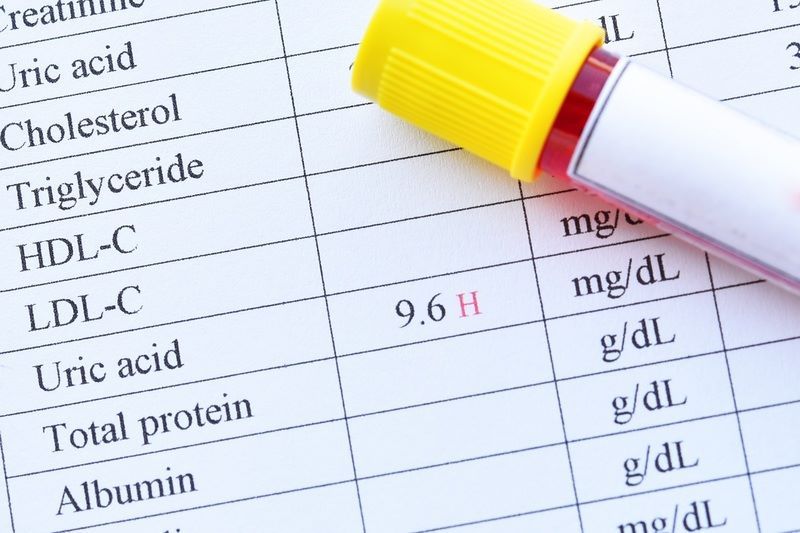 Hướng dẫn cách đọc kết quả xét nghiệm máu tổng quát chi tiết 