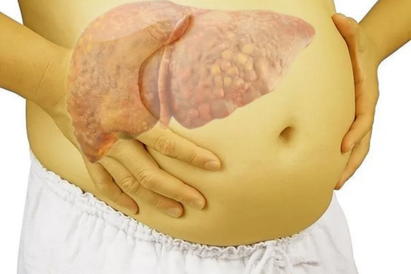 UNG THƯ GAN GIAI ĐOẠN CUỐI SỐNG ĐƯỢC BAO LÂU LÀ LO LẮNG CHUNG