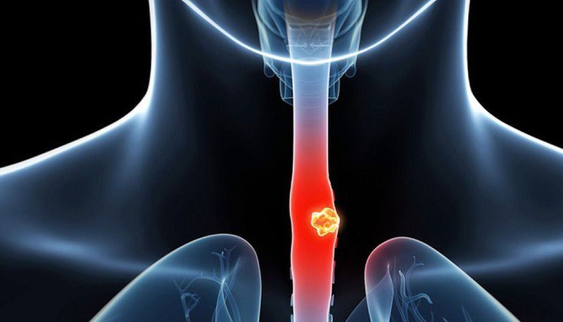 Tham khảo ý kiến chuyên gia tại Pharmacity giúp người bệnh chuẩn bị thể trạng tốt nhất trước khi mổ