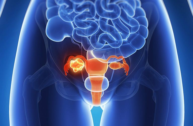 Việc thăm khám định kỳ giúp kiểm soát các biến chứng ở giai đoạn cuối