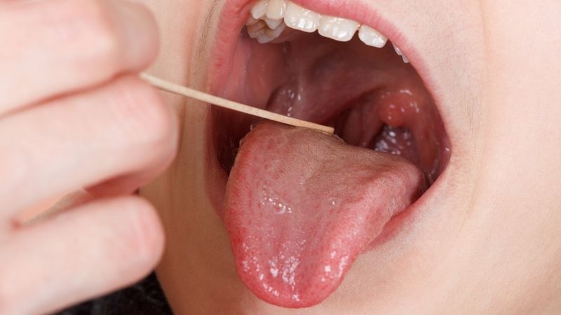 Thăm khám nha khoa định kỳ giúp phát hiện sớm các bất thường trong khoang miệng