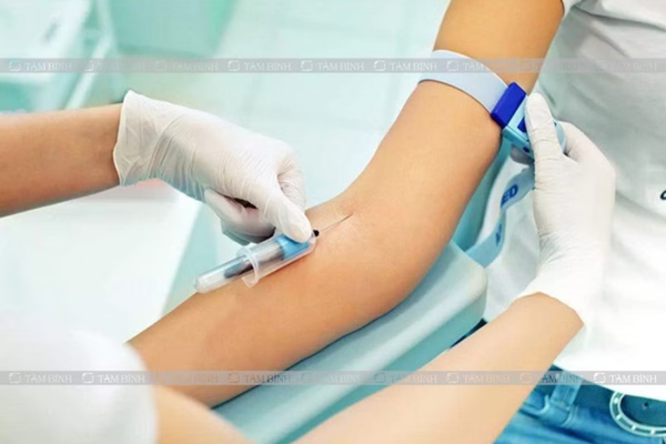 Các xét nghiệm đo tải lượng virus định kỳ giúp bác sĩ điều chỉnh phác đồ phù hợp