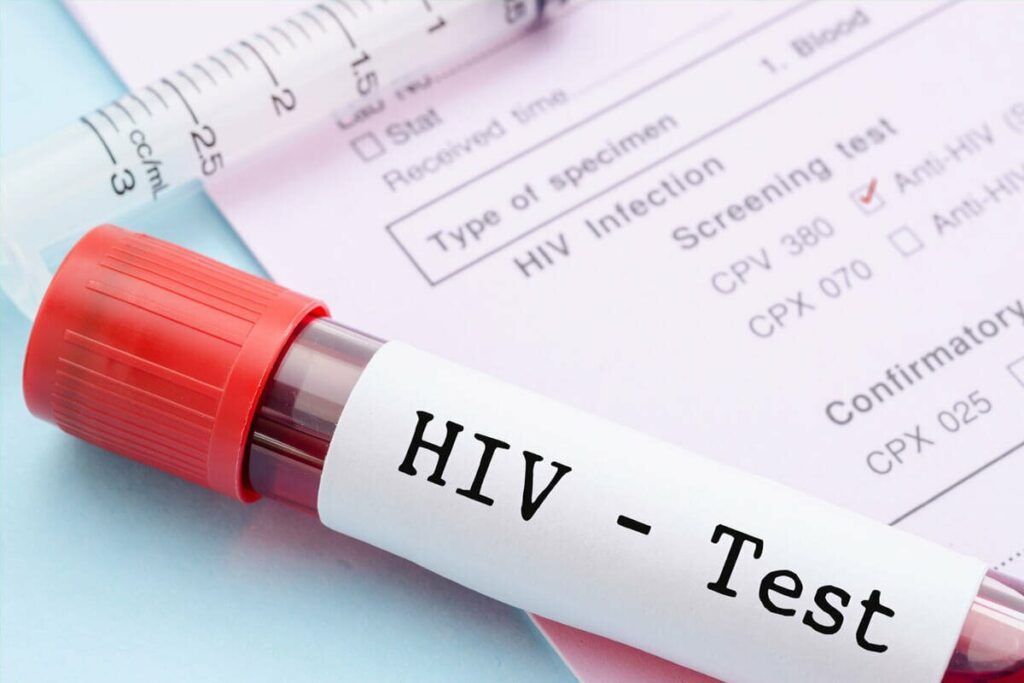 Các xét nghiệm HIV chuyên biệt giúp phát hiện virus hoặc kháng thể chống lại virus trong cơ thể