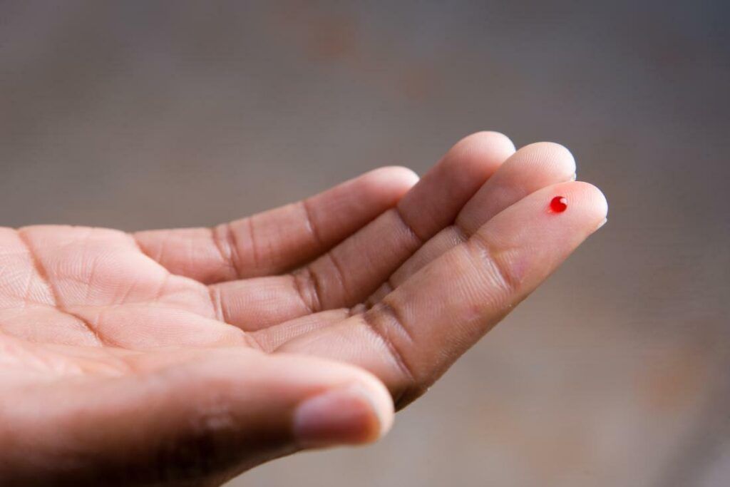 Xét nghiệm máu thông thường giúp đánh giá sức khỏe tổng quát nhưng không dùng để phát hiện HIV